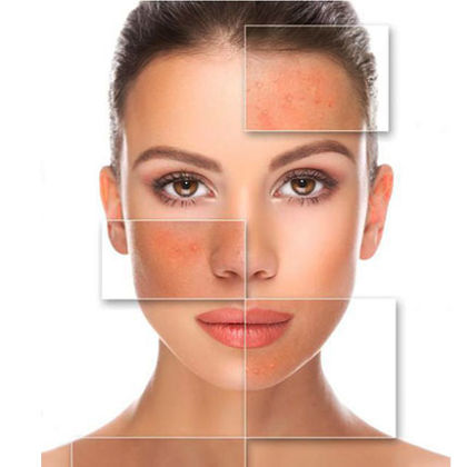 تشخیص نوع پوست برای انتخاب بهتر روتین بهداشتی