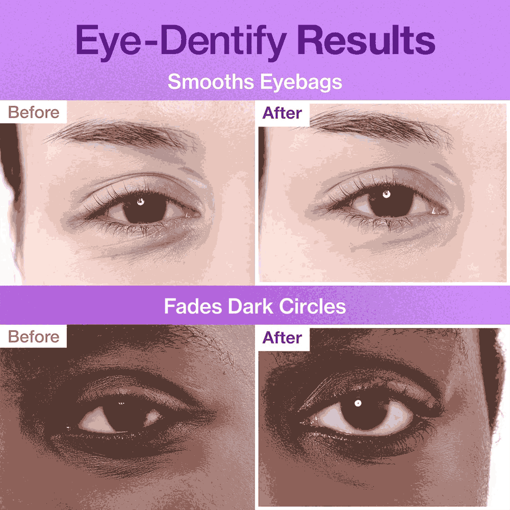 پچ زیر چشم نامبوزین 9+ ضد چروک، ضدپف و تیرگی (Numbuzin)