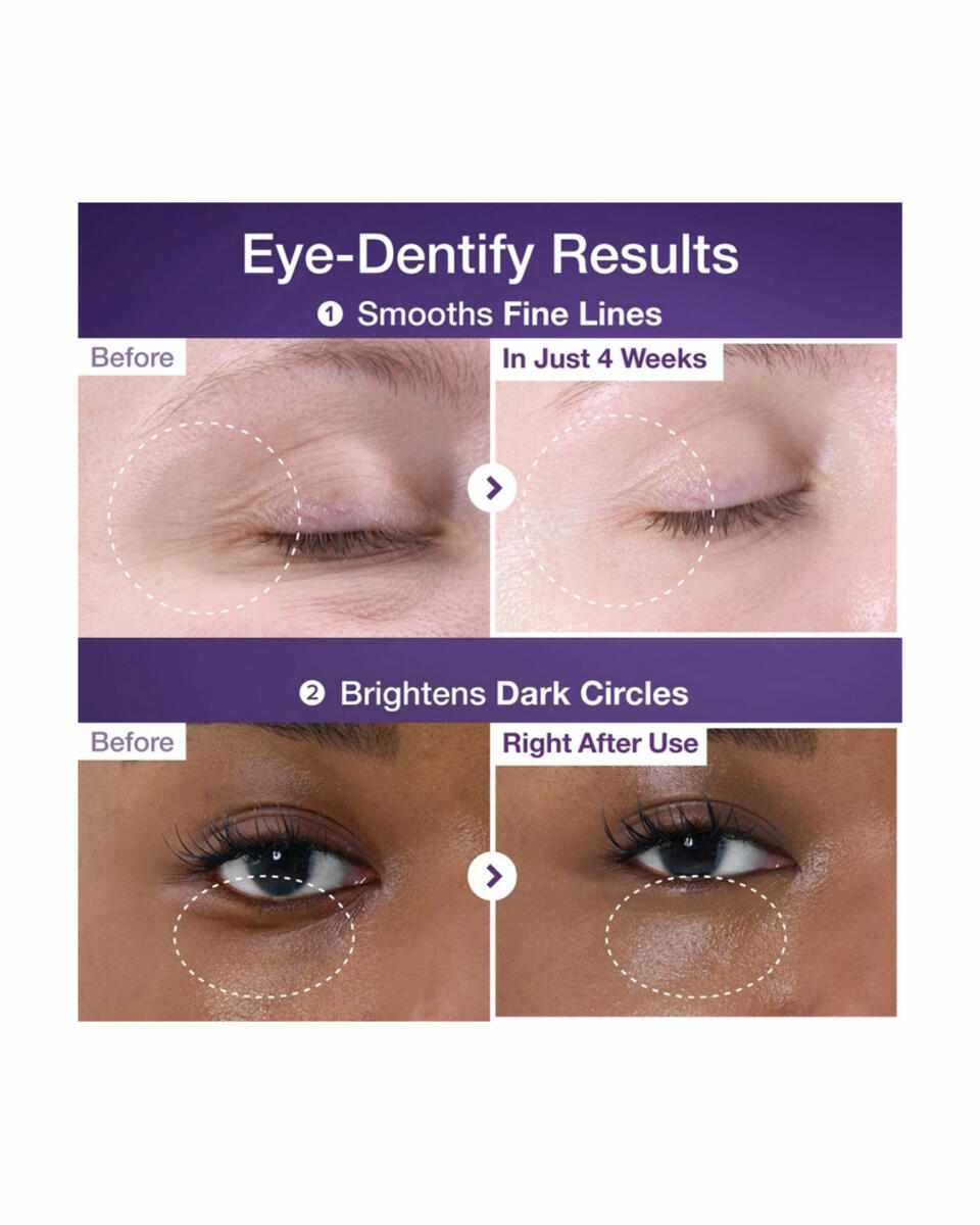 کرم دور چشم رتینول و NAD جوانساز نامبوزین (numbuzin)