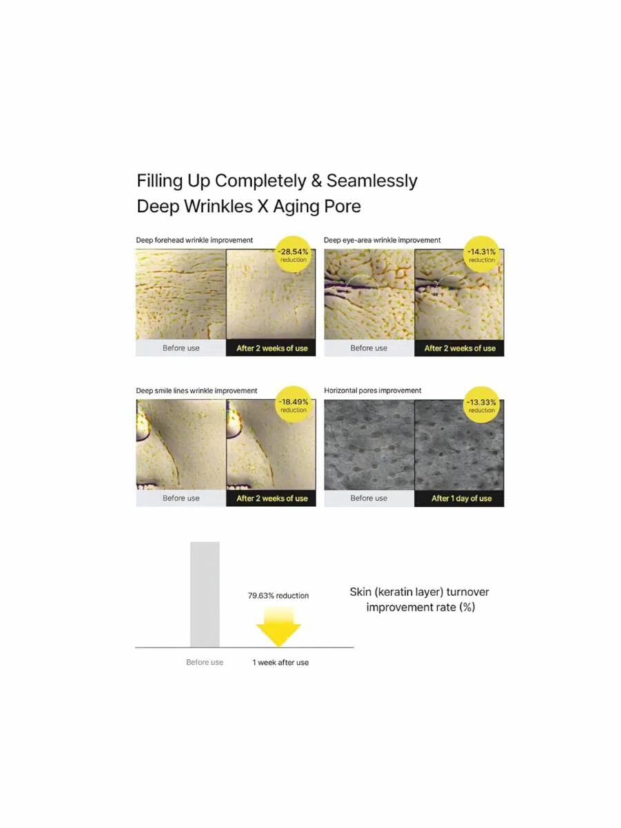 کرم لیفت کننده قوی و ضد چروک رتینول شات سلیمکس ( Celimax )
