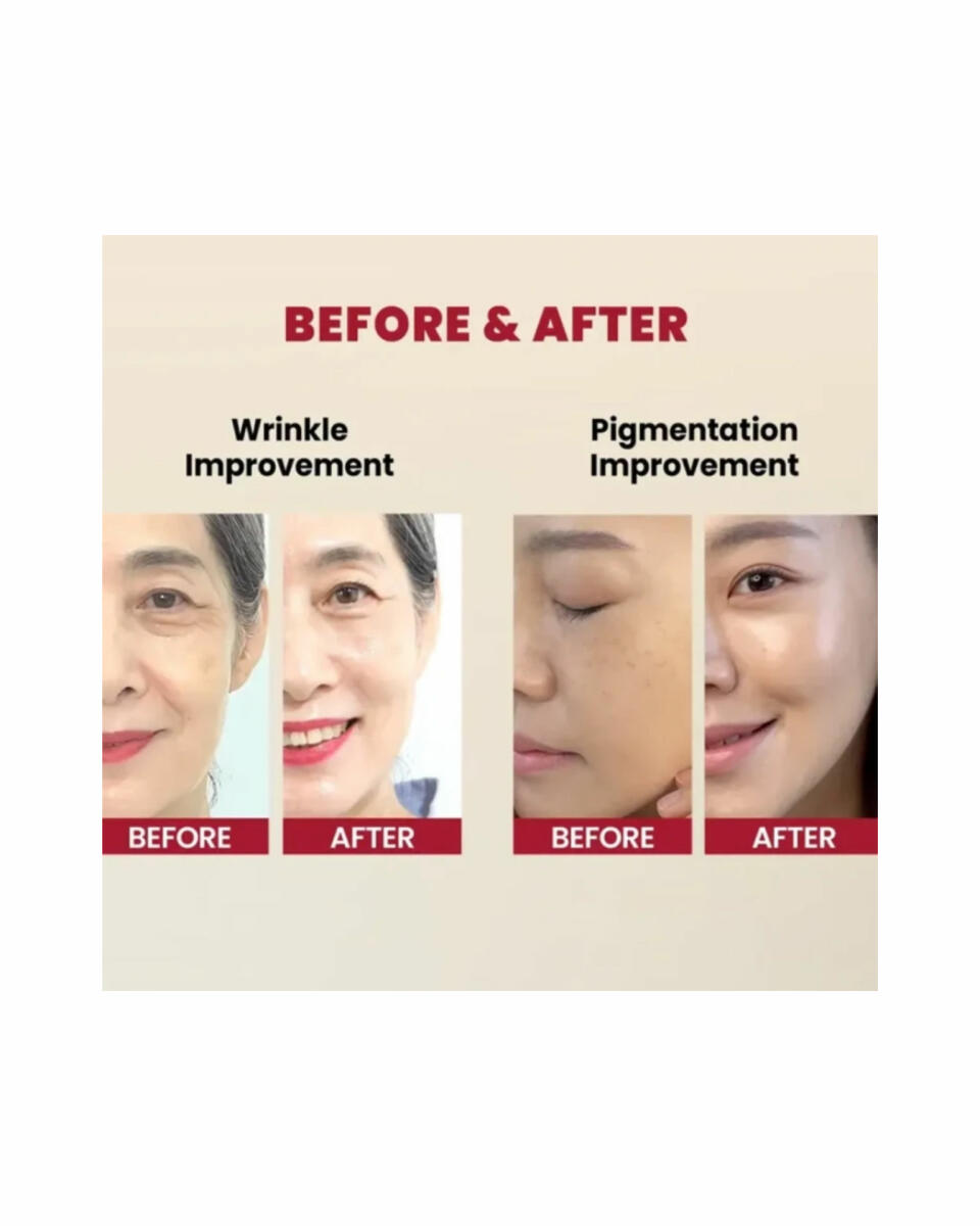 سرم رتینال جوانساز لیپوزومال سئول ۱۹۸۸ (SEOUL 1988)