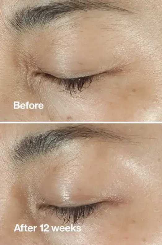 کرم دور چشم ضد چروک کلینیک (Clinique)