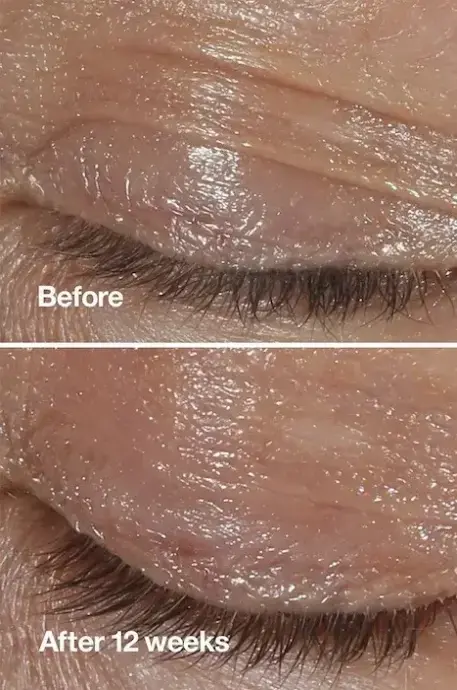 کرم دور چشم ضد چروک کلینیک (Clinique)